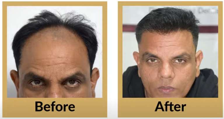 -64-Testimonial-by-Dheeraj-for-Dermadent-Clinic-YouTube-03-15-2025_08_59_AM
